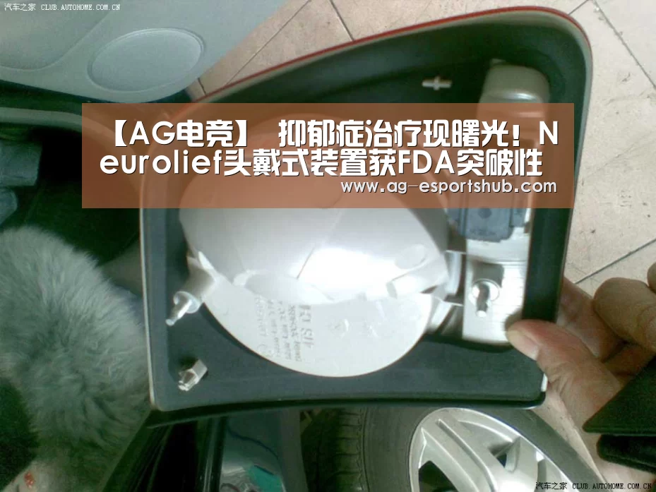 AG电竞